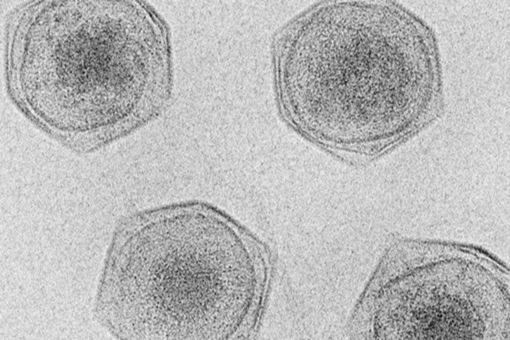 Khám phá 230 Virus Khổng Lồ Dưới Biển – “Girus” Tương Tác Với Quang Hợp